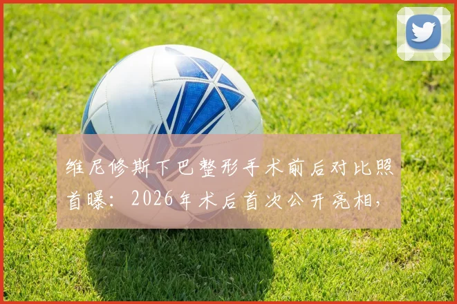 维尼修斯下巴整形手术前后对比照首曝:2026年术后首次公开亮相,状态恢复引关注